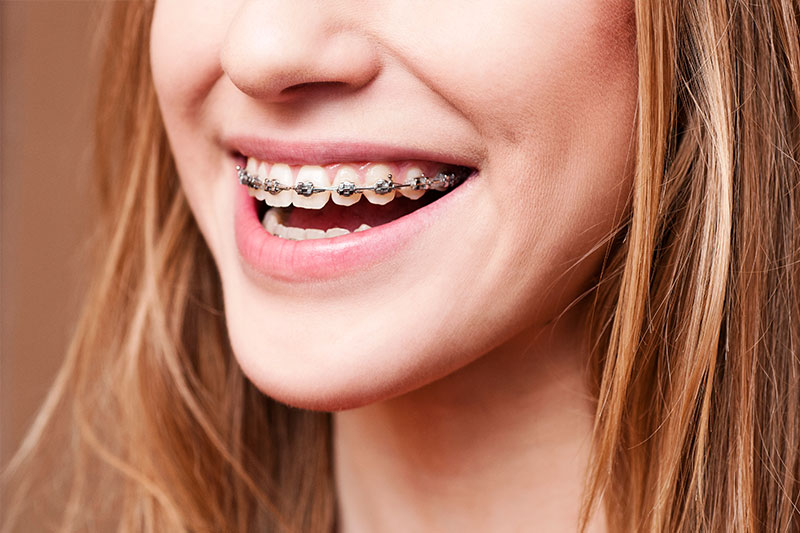 Oklahoma City Orthodontics